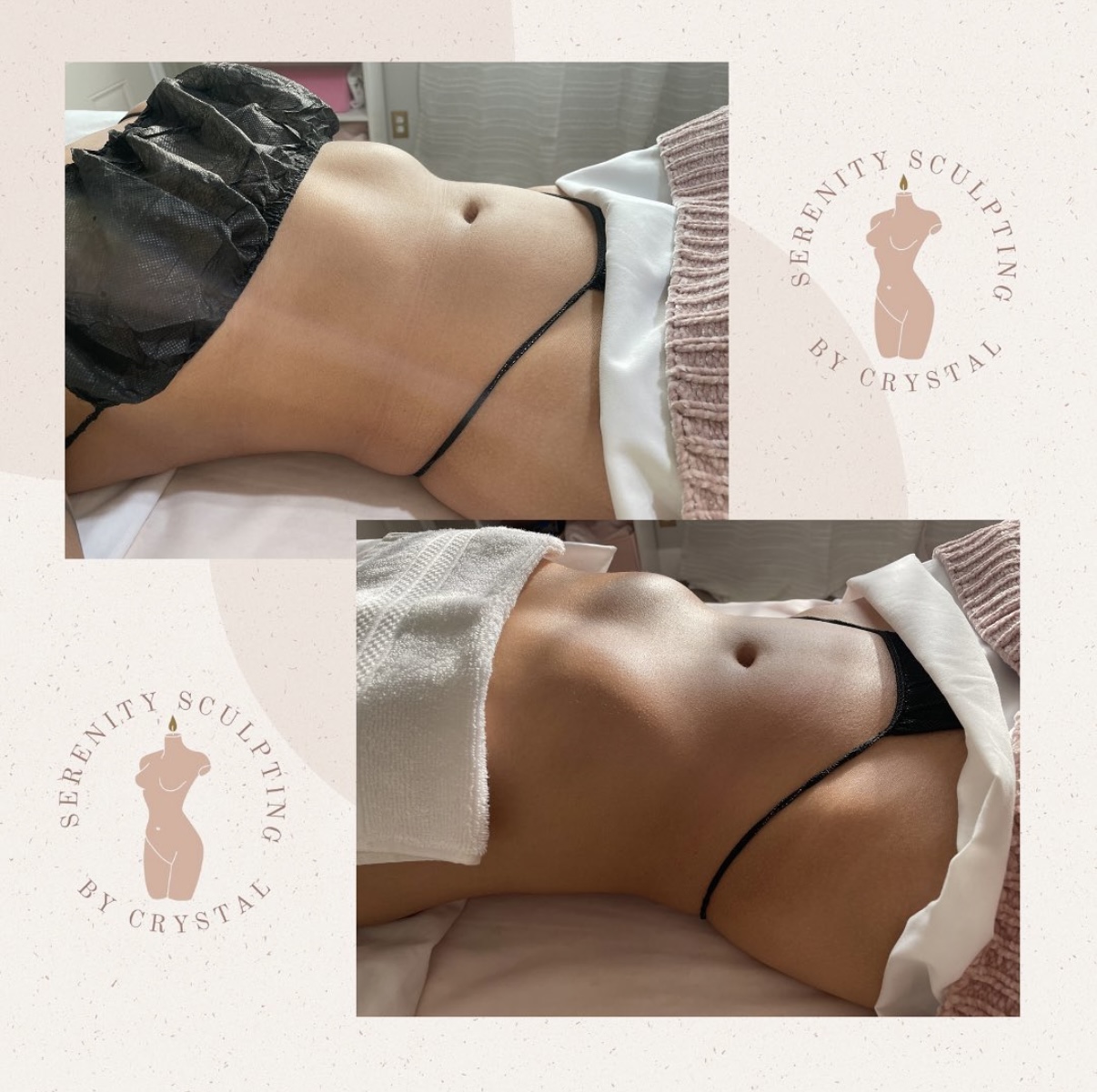 Before and after — sculpting results